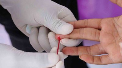 ÜLKEMİZDE EN ÇOK  ANTALYA, ANTAKYA, MERSİN GİBİ BÖLGELERDE GÖRÜLEN