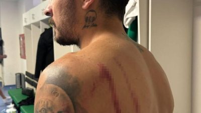 MAÇ SONU YAŞANAN ARBEDEDE YARALANAN KOCAELİSPOR'UN FUTBOLCULARINDAN AHMET SOSYAL MEDYA