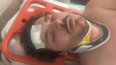 Kocaeli’nin Gebze ilçesinde trafikte yaşanan tartışma sonucu darp edilen oyuncu