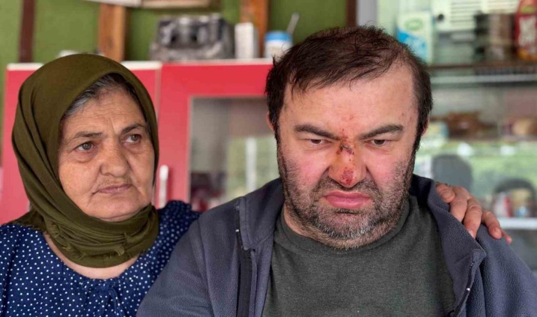 Bolu’da yüzde 90 engelli 45 yaşındaki Murat Kepil’in, “çocuklar rahatsız