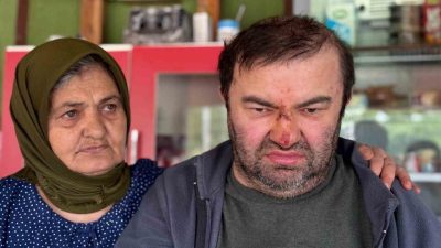 Bolu’da yüzde 90 engelli 45 yaşındaki Murat Kepil’in, “çocuklar rahatsız