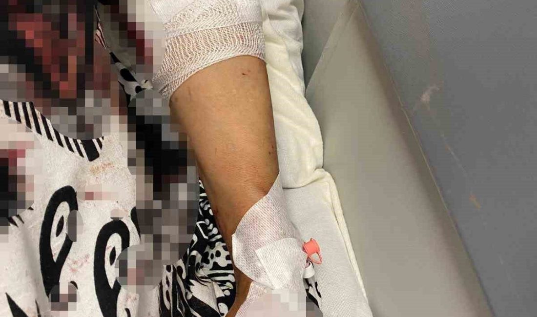 Abdest almak için bahçeye çıkan kadına köpekler saldırdı Kocaeli’nin Kartepe ilçesinde su kesintisi nedeniyle abdest almak için bahçeye