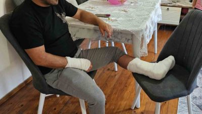 Kastamonu’nun Cide ilçesinde sokak köpeğinin saldırısına uğrayan vatandaşın ayağı iki