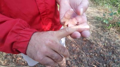 Bolu’nun Mudurnu ilçesinde fındık bahçesinde ayının saldırdığı kişi, bir parmağını
