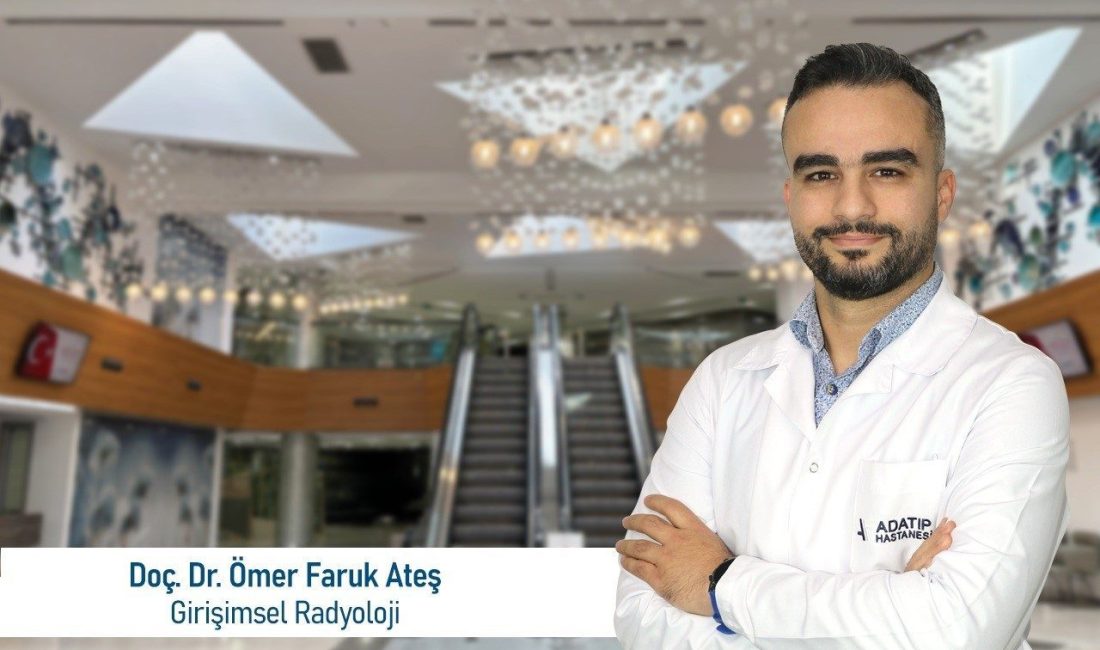 Doç. Dr. Ömer Faruk Ateş: “Tiroid nodüllerinde ameliyatsız tedavi mümkün” Girişimsel Radyoloji Uzmanı Doç. Dr. Ömer Faruk Ateş, tiroid nodüllerinin