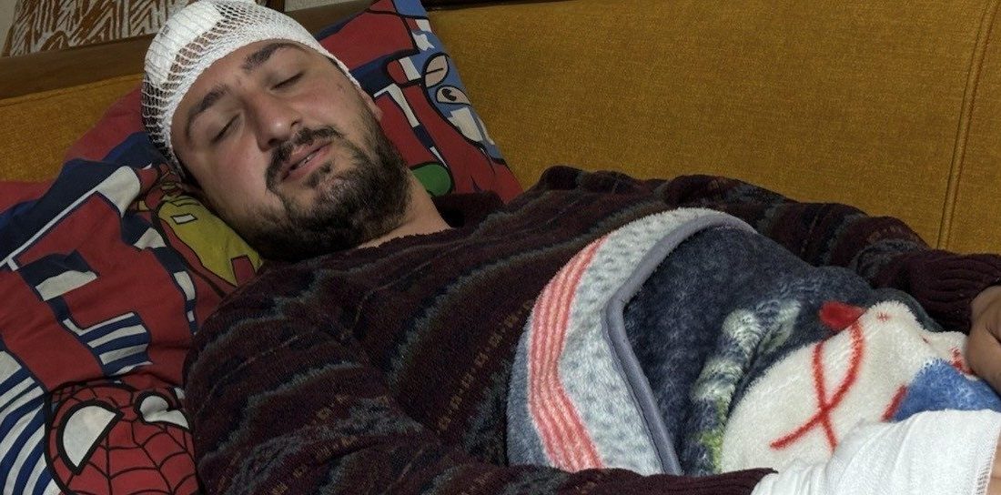 Kocaeli’nin İzmit ilçesinde 4 gün önce odunluğa baktığı gerekçesiyle yüzde