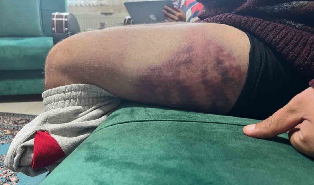 Vicdanları yaralayan olay: Otizmli şahıs odunluğa baktı diye odunla darbedildi Kocaeli’nin İzmit ilçesinde yüzde 85 otizmli ve epilepsi hastası şahsın