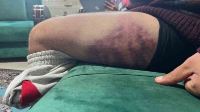 Kocaeli’nin İzmit ilçesinde yüzde 85 otizmli ve epilepsi hastası şahsın