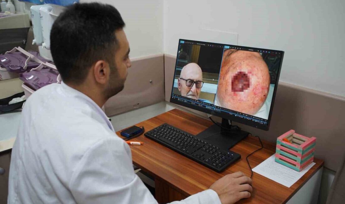 Saçlı deride görülen ve dünyada son derece nadir rastlanan tümör