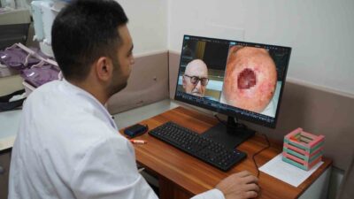 Saçlı deride görülen ve dünyada son derece nadir rastlanan tümör