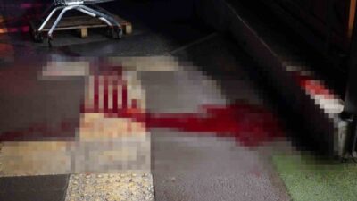 Sakarya’nın Adapazarı ilçesinde çıkan kavgada bir kişi kesici aletle göğsünden