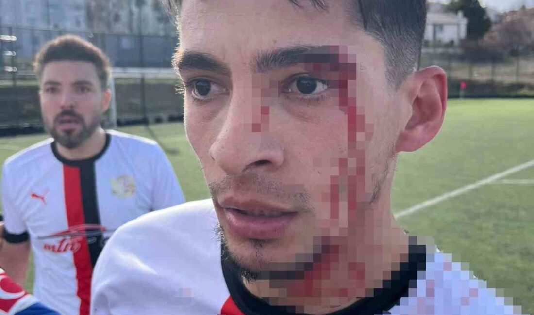 Bilecik’te oynanan amatör futbol müsabakasının bitiş düdüğü sonrası kavga çıkarken,