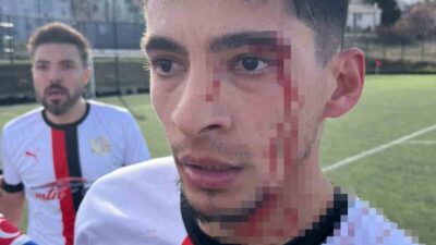 Bilecik’te oynanan amatör futbol müsabakasının bitiş düdüğü sonrası kavga çıkarken,