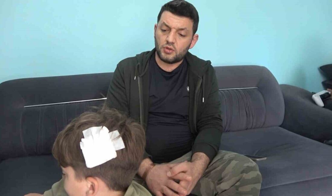 Yalova’nın Çınarcık ilçesinde komşu kavgasında scooter ile saldırıya uğrayan baba